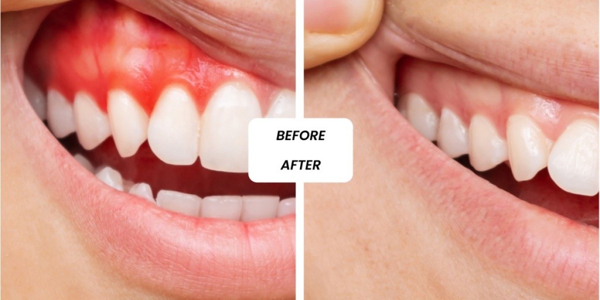 Cosmetic Dentistry in Dubai: Smile Makeovers with Modern Dentistry