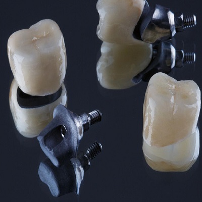 Zirconia Crowns in Islamabad Pakistan | Zirconia Crowns Cost