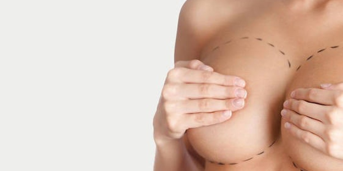 Why Breast Surgery in Dubai Is a Popular Choice for Aesthetic Enhancement | Complete Guide