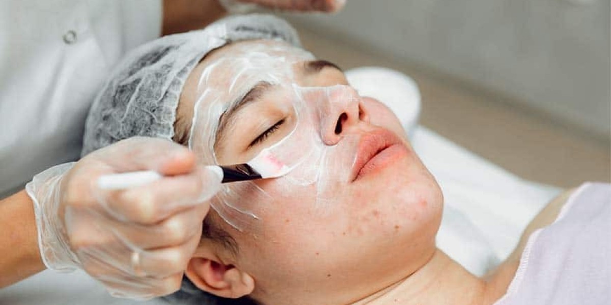 Chemical Peels in Dubai for Acne and Scar Care