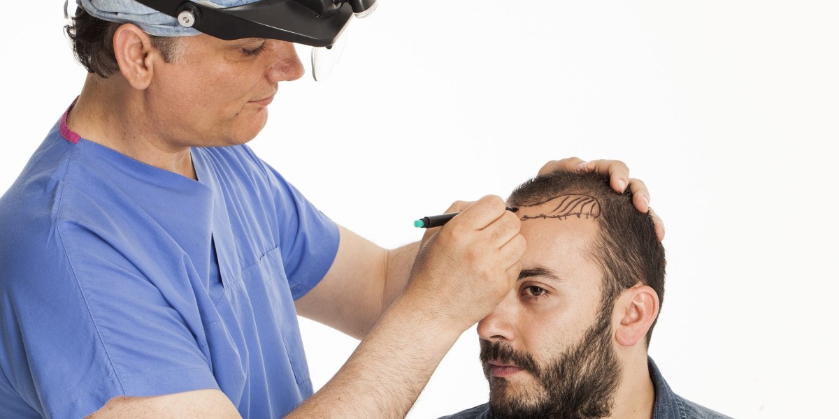 Hair Transplant in Dubai: Complete Recovery Guide