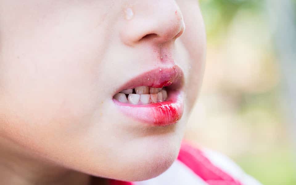Emergency Dental Services in Hamilton, ON | Expert Guide