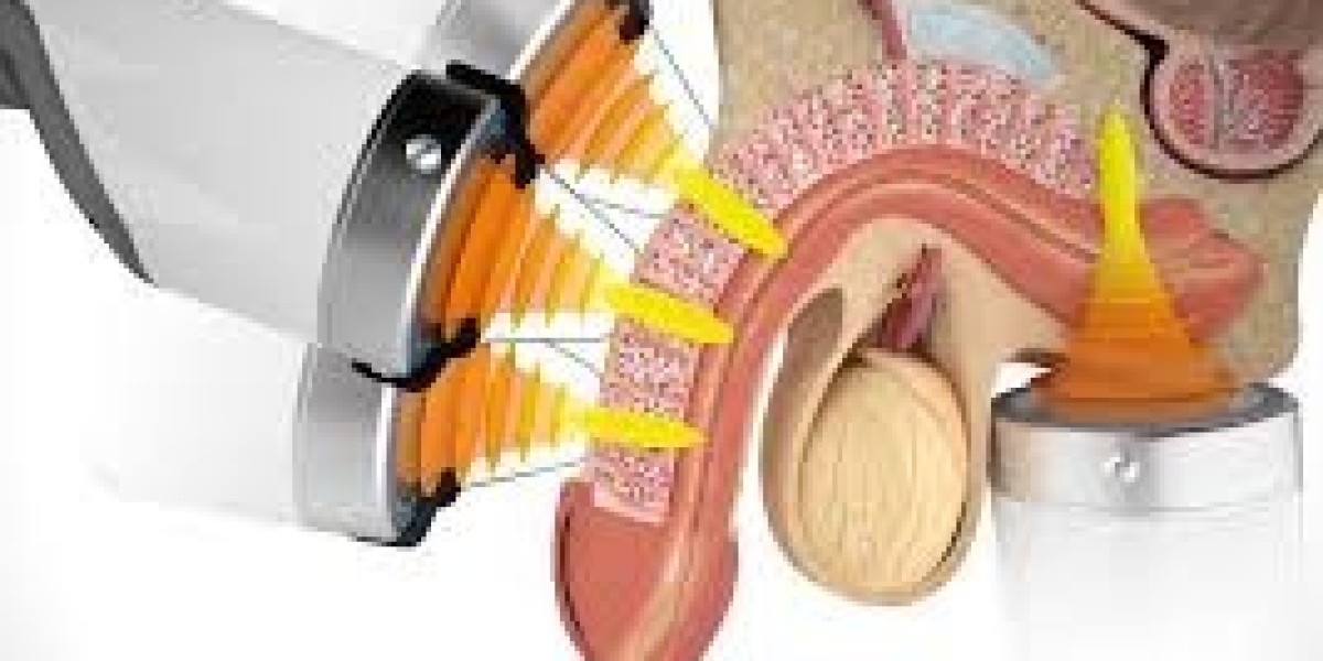 Effective Erectile Dysfunction Treatment in Dubai for Men Seeking Better Performance