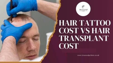 Hair Tattoo Cost vs Hair Transplant Cost: Which Option Offers Better Value