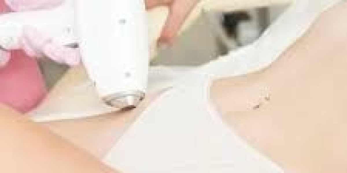 Electrolysis Hair Removal in Dubai: Treatment Process, Benefits & Results