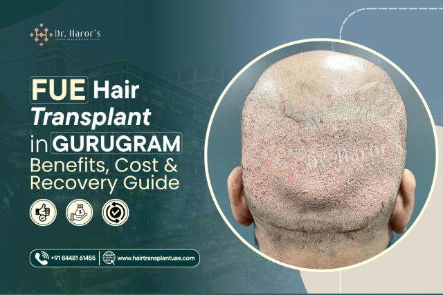FUE Hair Transplant in Gurugram: Benefits, Cost & Recovery Guide – @gurugramdhw on Tumblr