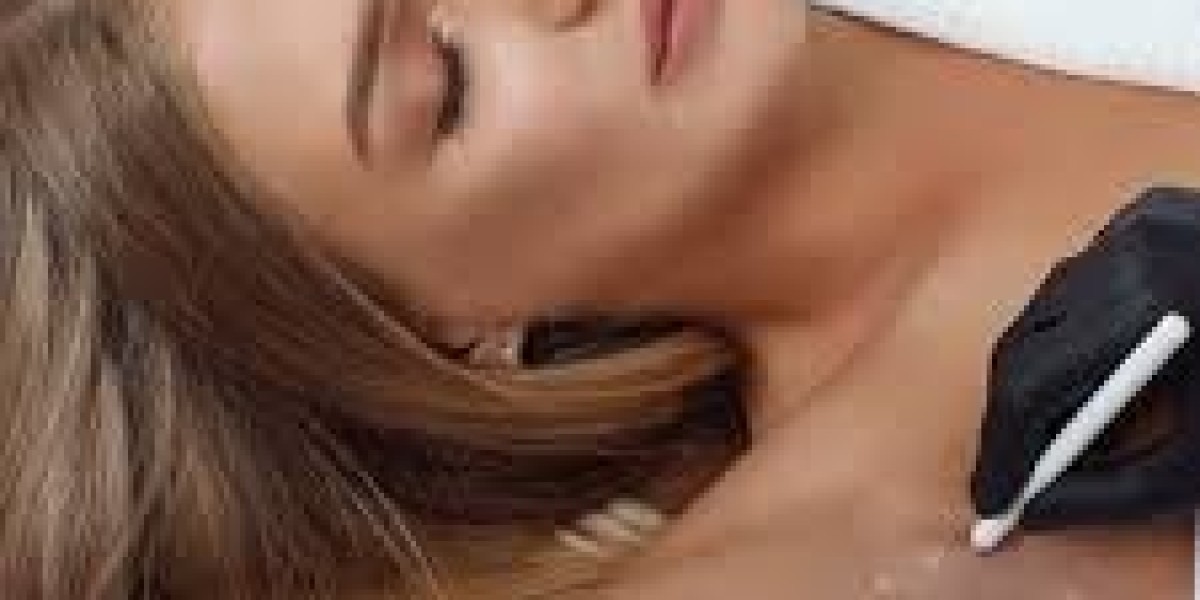 Hyperhidrosis Treatment in Dubai | Benefits, Procedure & Aftercare Guide