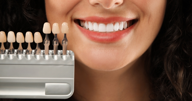 Best Cosmetic Dentist Seattle | Aesthetic & Full-Mouth Reconstruction