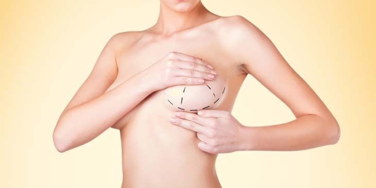 Breast Reduction in Dubai: Surgical Techniques and Modern Advances