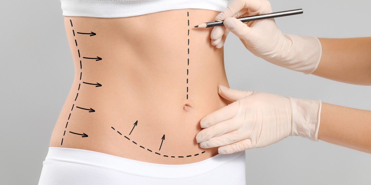 Body Contouring in Islamabad: Everything You Should Know About Recovery