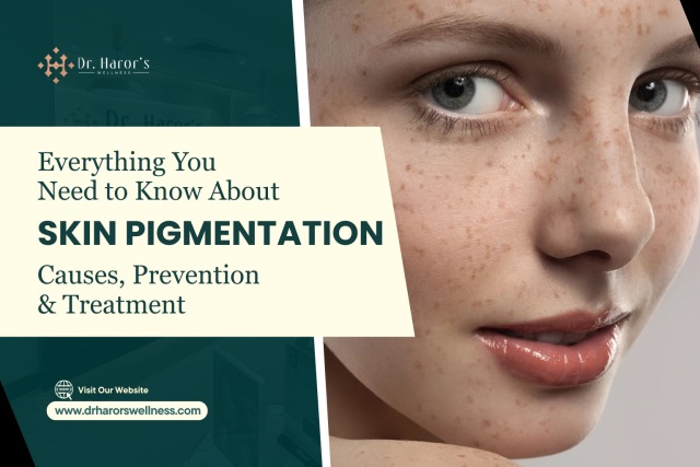 Everything You Need to Know About Skin Pigmentation: Causes, Prevention & Treatment – @drharorswellnessgk on Tumblr