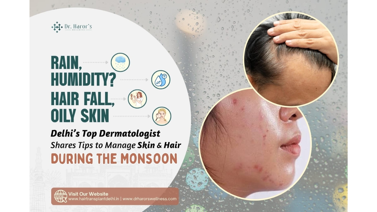 Rain, Humidity, Hair Fall, Oily Skin? Delhi’s Top Dermatologist Shares Tips to Manage Skin & Hair During the Monsoon - Up18 News