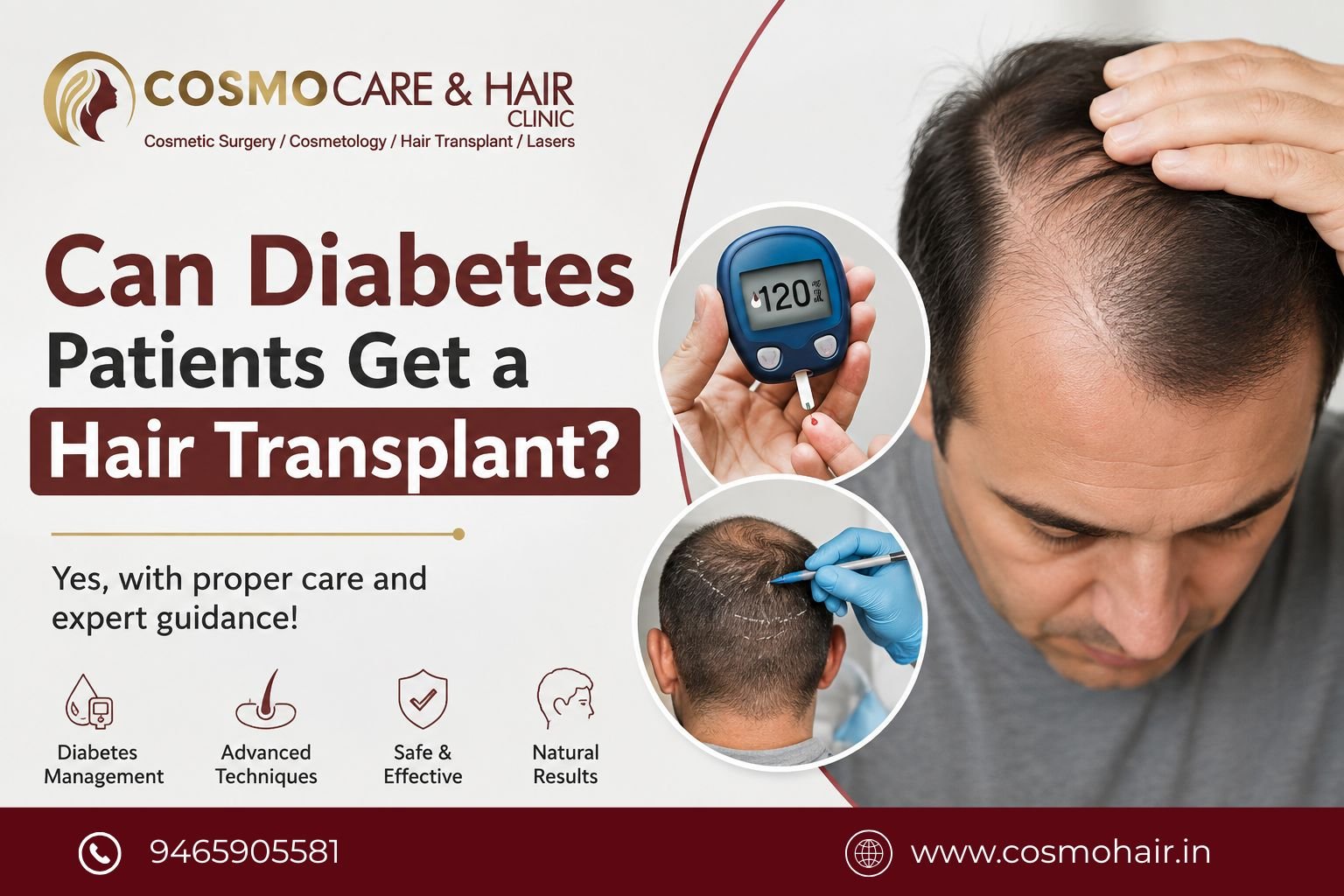 Can Diabetes Patients Get a Hair Transplant? Complete Guide