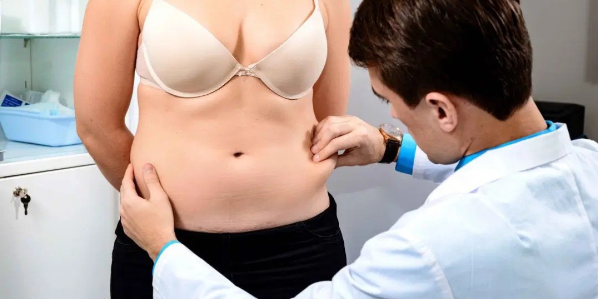 Abdominoplasty Dubai: The Journey to a Tighter and Flatter Midsection