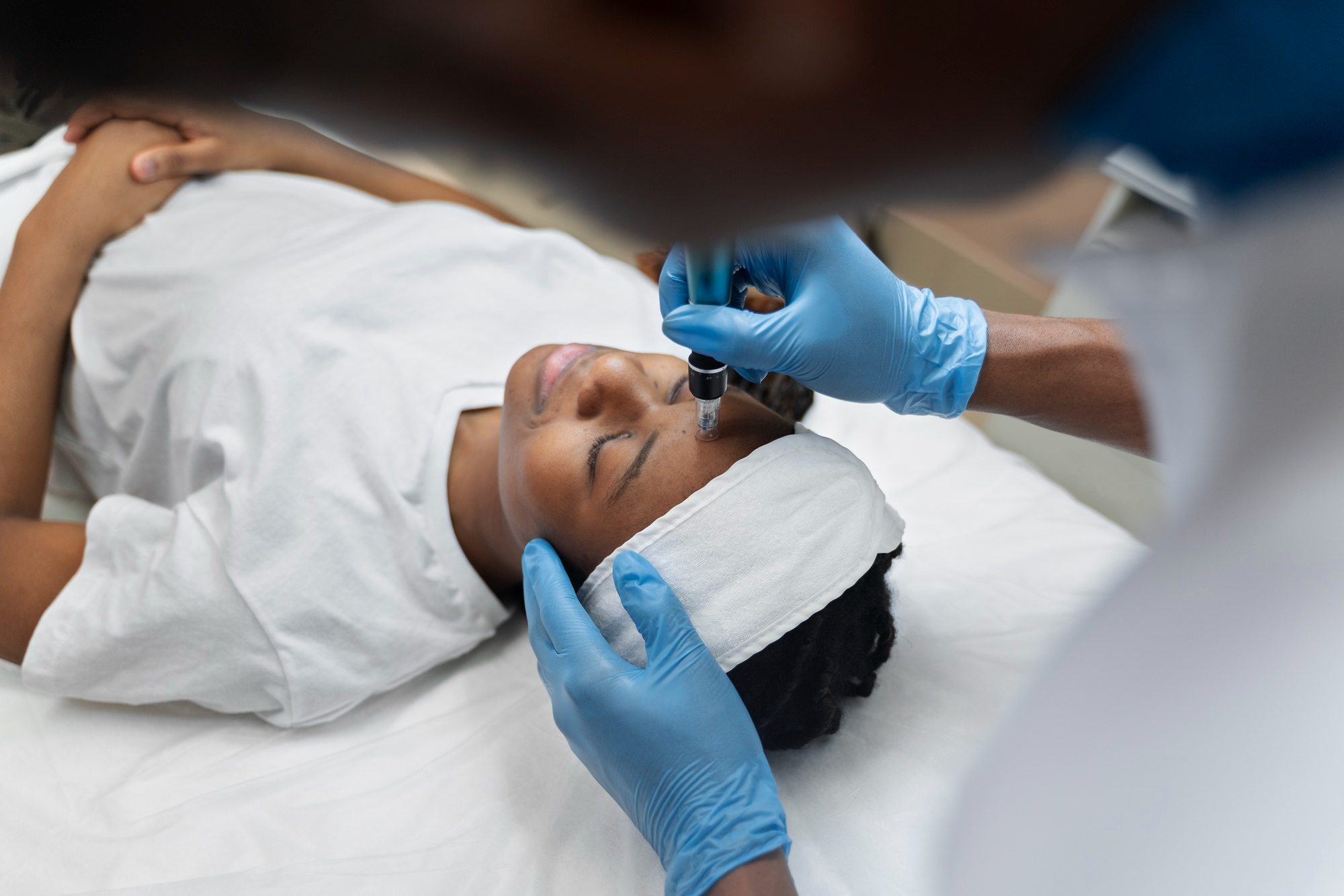 Laser Hair Removal for Dark Skin Guide Bristol Tips