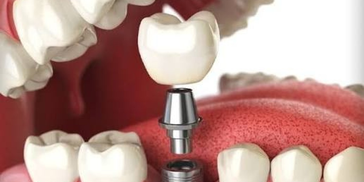 Dentist Near Me: Discover Trusted Dental Care for Everyday Smiles and Emergency Dental Needs