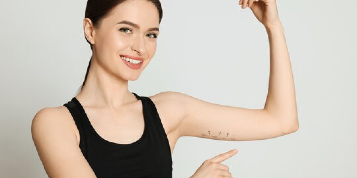 Arm Lift Surgery in Dubai for Defined Upper Arms