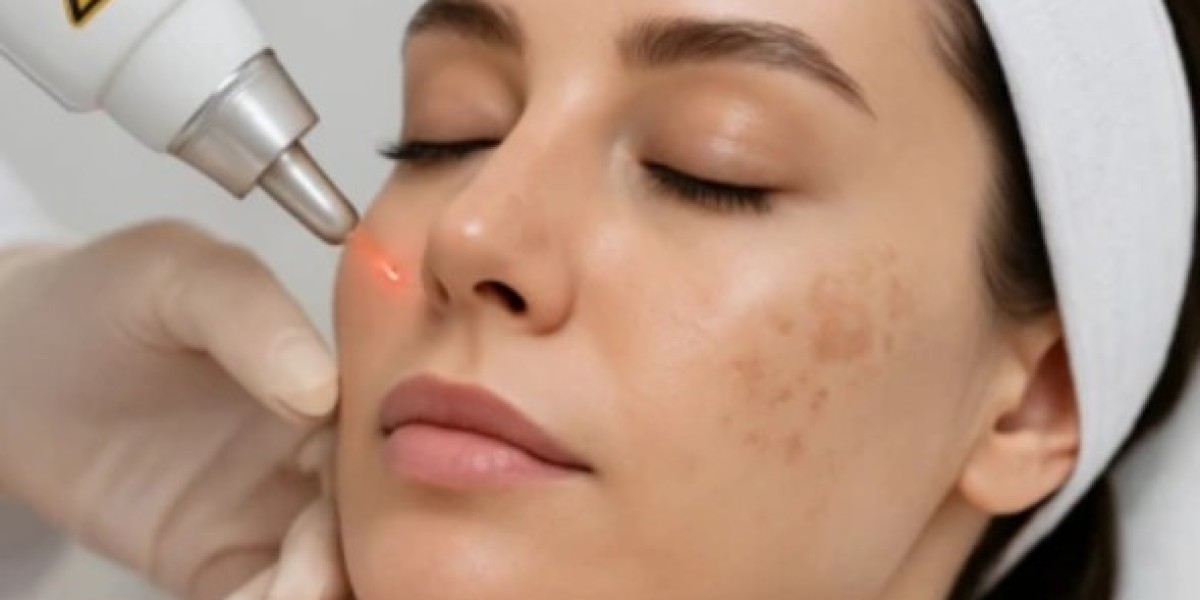 Pigmentation Treatment In Dubai: Modern Solutions for a More Even Skin Tone