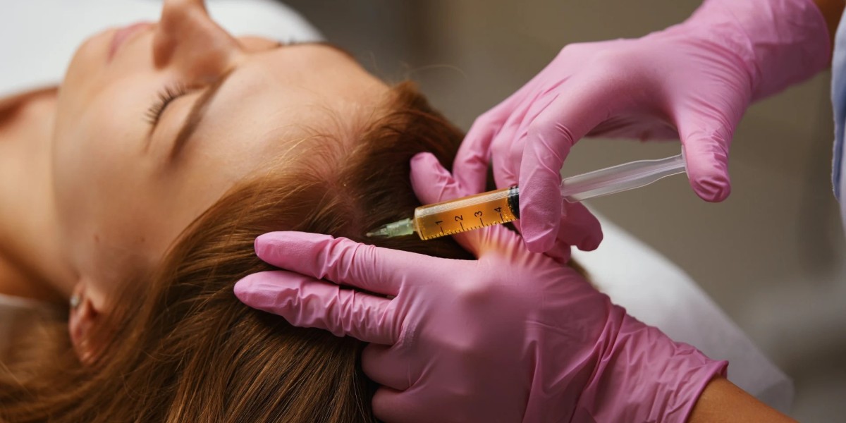PRP Hair Treatment in Dubai: Step-by-Step Procedure Guide
