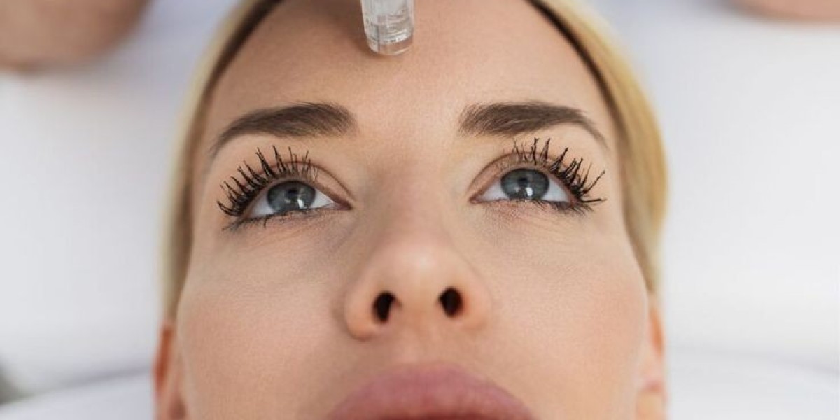 Microneedling with PRP in Dubai for Skin Renewal
