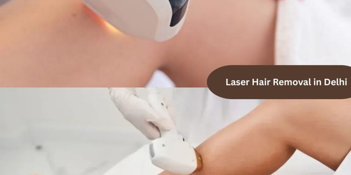 Say Goodbye to Constant Waxing: What You Should Know About Laser Hair Removal