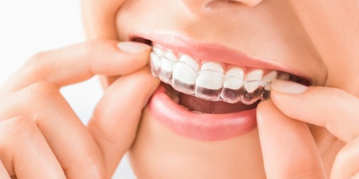 How to Clean Your Invisalign Brisbane Aligners Properly
