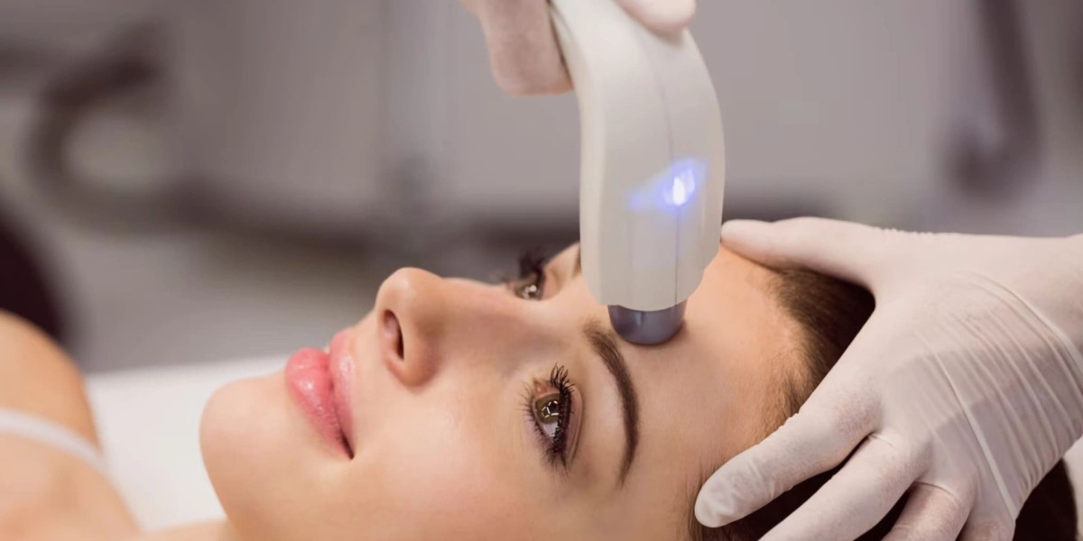 Laser Toning: A Modern Treatment for Pigmentation
