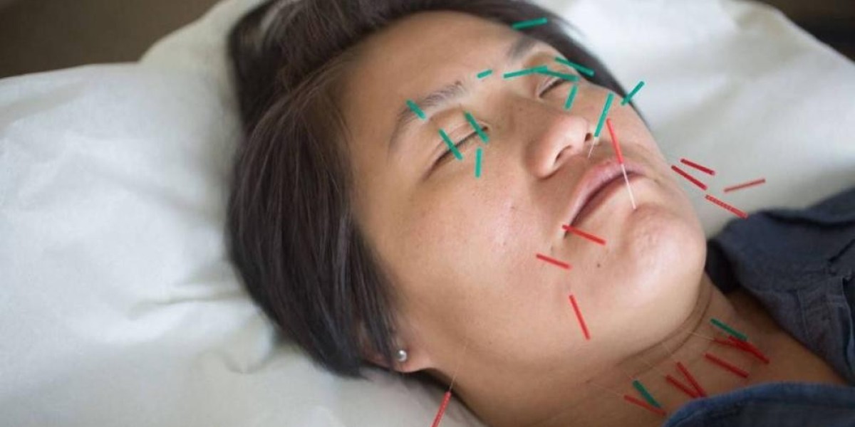 Cosmetic Acupuncture Timeline | Acupuncture Clinic Oakland
