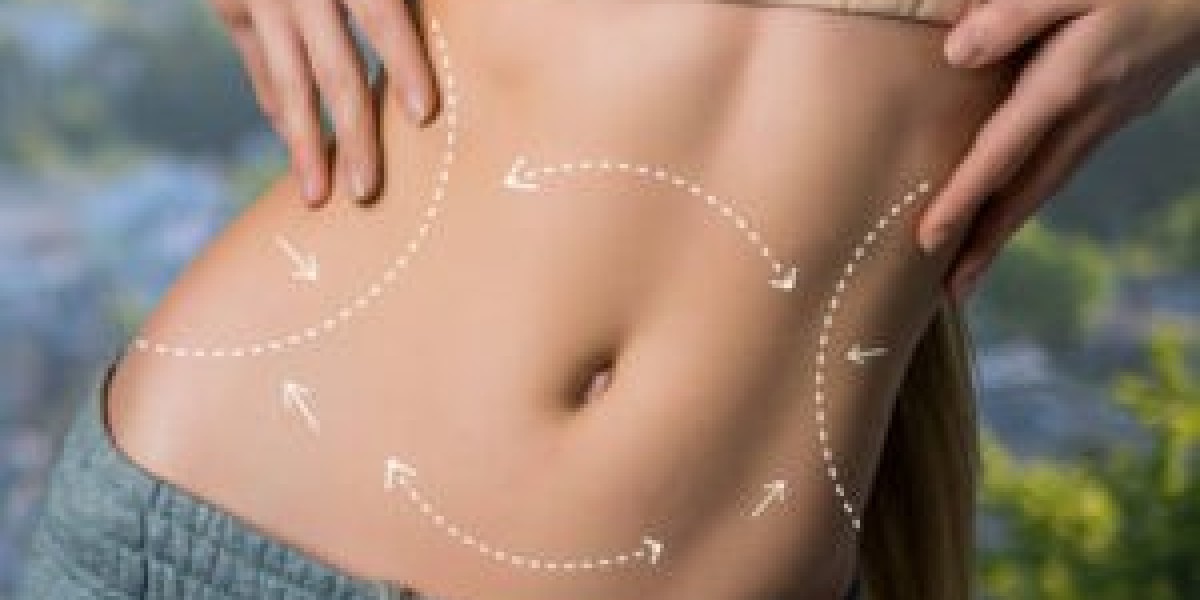 Advanced Liposuction in Dubai: Sculpting Your Physique