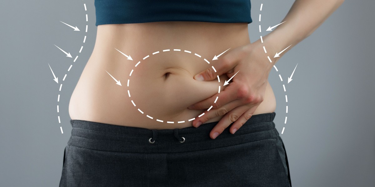How Pregnancy Can Change the Abdomen and How Tummy Tuck in Islamabad Helps
