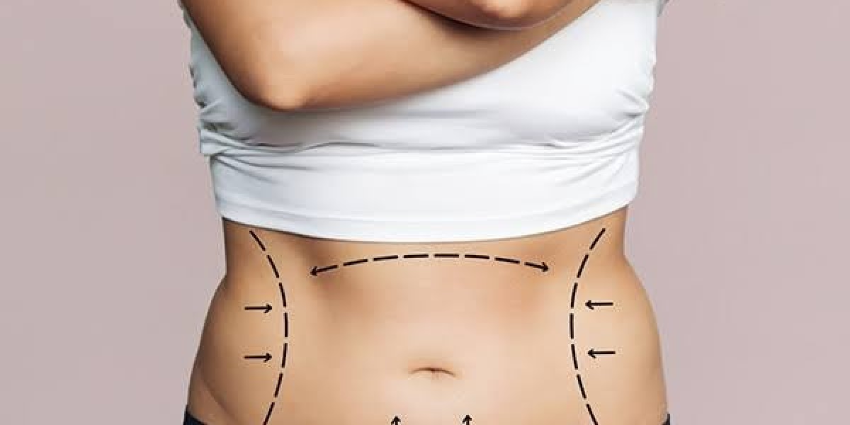 Premier Tummy Tuck in Dubai: Renew Your Confidence