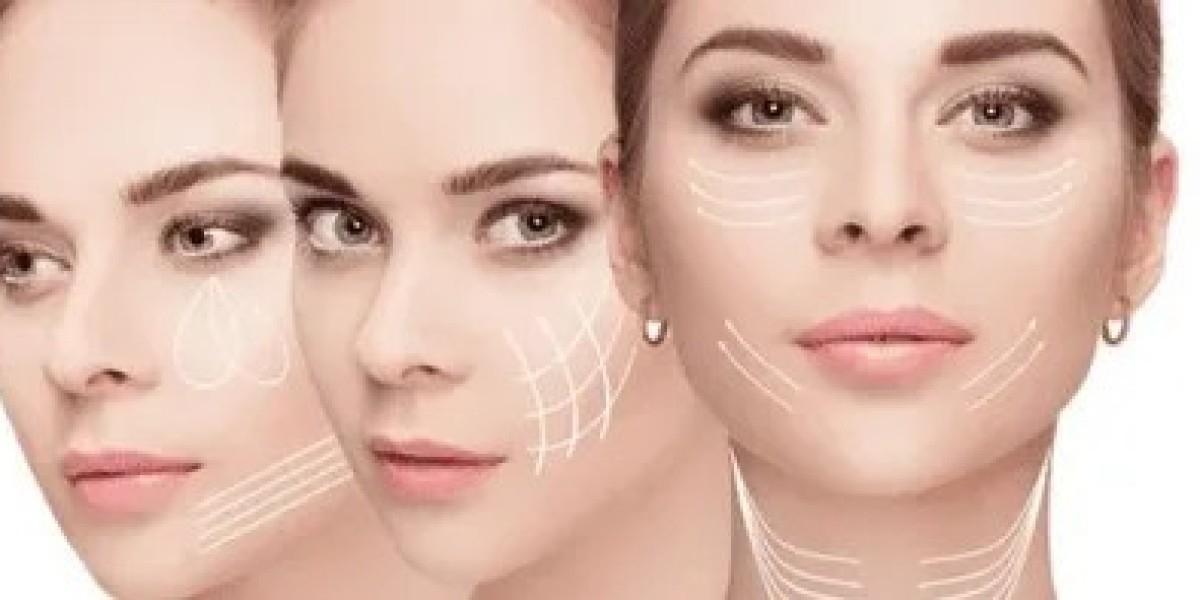 Thread Lift in Dubai: Aesthetic Excellence for Contoured Youth