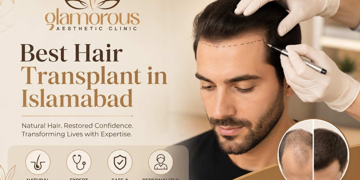 Best Hair Transplant in Islamabad
