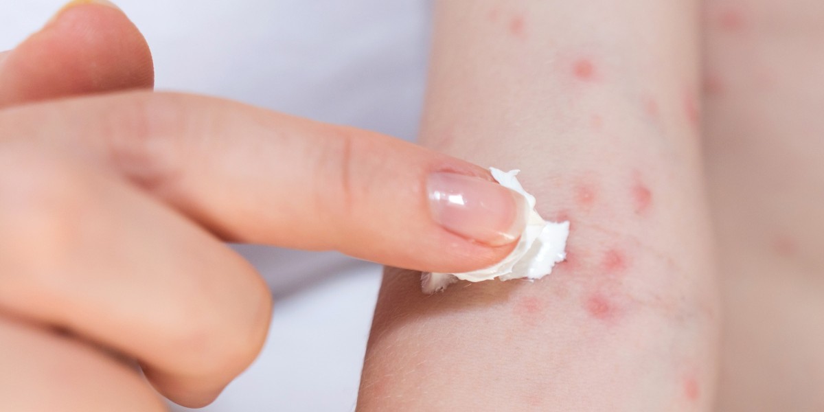 Best Skin Allergies Doctor In Assam for Advanced Allergy Care, Itching Relief & Healthy Skin Solutions