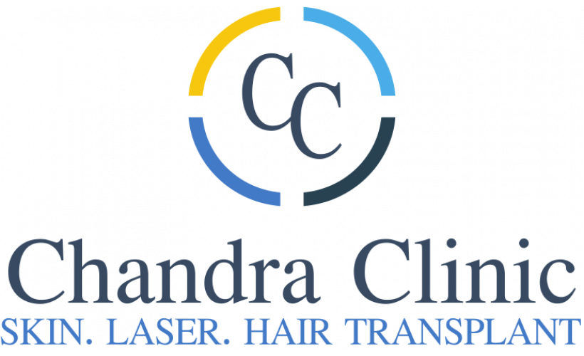 Losing Hair? Here’s How to Choose the Right Treatment in Delhi – Best Hair Transplant Doctor In Delhi