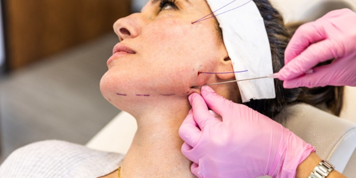 Thread Lift in London: Understanding the Modern Non-Surgical Approach
