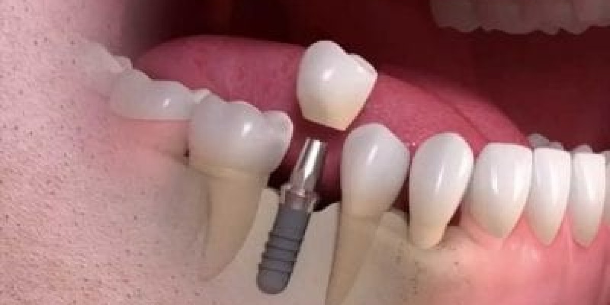 Dental Emergencies Made Easier: How to Find the Right Dentist Near You