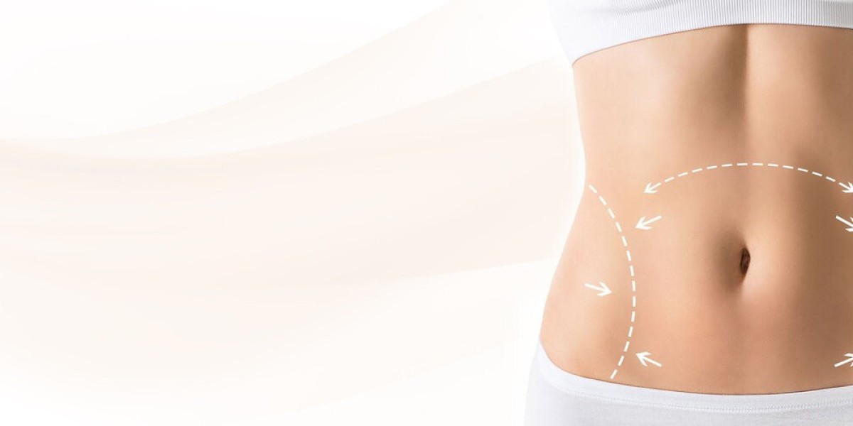 Tummy Tuck Dubai: What to Know Before Booking