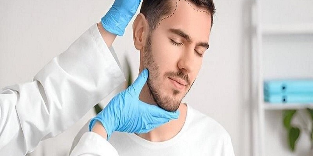 Hair Transplant in Dubai: Is the Treatment Safe?